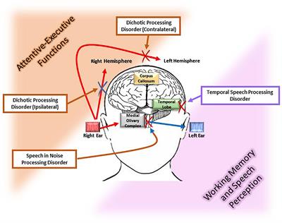 The Age-Related Central Auditory Processing Disorder: Silent Impairment of the Cognitive Ear